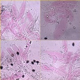 Coprinopsis echinospora image