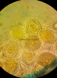 Endogone incrassata image