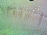 Acarospora americana image