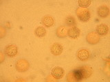 Reticularia lycoperdon image