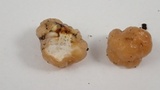 Tremella encephala image