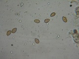 Coniophora puteana image