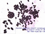 Coprinellus limicola image