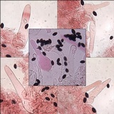 Coprinellus limicola image
