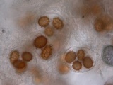 Tuber mesentericum image