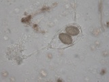 Tuber rufum image