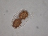 Tuber uncinatum image