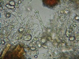 Hyphoderma capitatum image