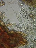 Hyphoderma capitatum image