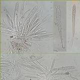 Coccomyces dentatus image