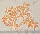 Fistulina hepatica image