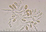 Fistulina hepatica image