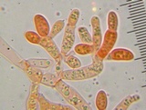 Fistulina hepatica image