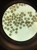 Scleroderma areolatum image