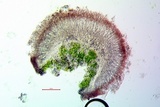 Caloplaca albovariegata image