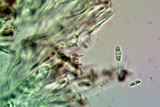 Caloplaca albovariegata image