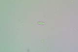 Caloplaca albovariegata image