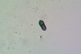Rinodina innata image