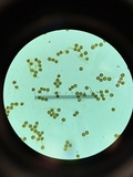Lycoperdon umbrinum image