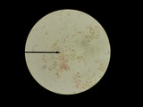 Tectella patellaris image