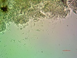 Aspicilia phaea image