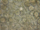 Tremella mesenterella image