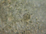 Tremella mesenterella image