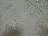 Tremella mesenterella image