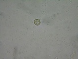 Tremella mesenterella image