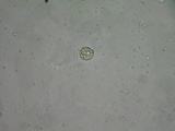Tremella mesenterella image