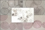 Coprinopsis tuberosa image