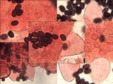 Coprinopsis tuberosa image