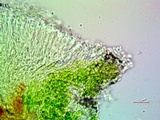 Lecanora substrobilina image