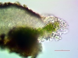 Lecanora substrobilina image