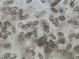 Calostoma cinnabarinum image