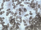 Calostoma cinnabarinum image