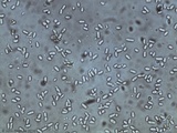 Cordyceps tenuipes image