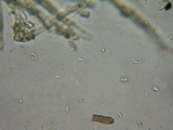 Phanerochaete laevis image