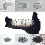 Diploschistes actinostomus image