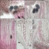 Diploschistes actinostomus image