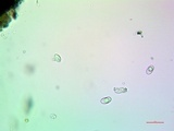 Lecidella asema image