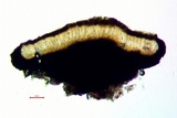 Cresponea chloroconia image