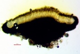 Cresponea chloroconia image