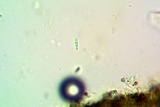Cresponea chloroconia image