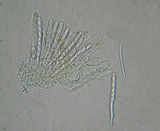 Lachnellula gallica image