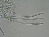 Lachnellula gallica image