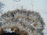 Bulgariella pulla image