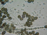 Bulgariella pulla image