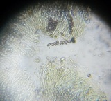 Ascobolus crenulatus image