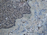 Porpidia albocaerulescens var. albocaerulescens image